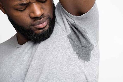 Hyperhidrosis treatment at Stonegate Medical Clinic